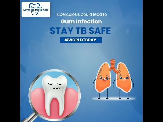 World Tuberculosis Day, Guru Maa Advanced Dental Care Rudrapur Uttarakhand